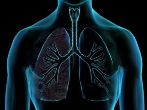 Pneumonia: O Alerta, no seu “Dia”